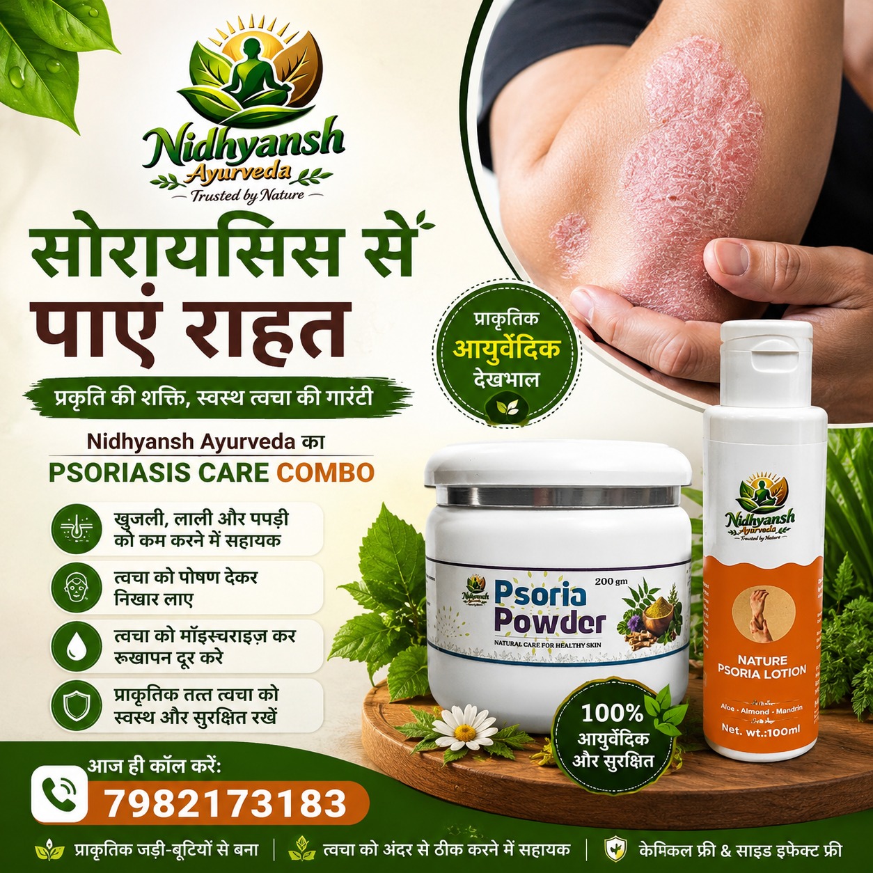 Psoriasis Care Kit
